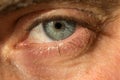 The manÃ¢â¬â¢s eye is gray-blue with red veins on it very close